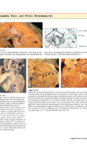 Atlas Of Cardiovascular Pathology P35 1000X1294
