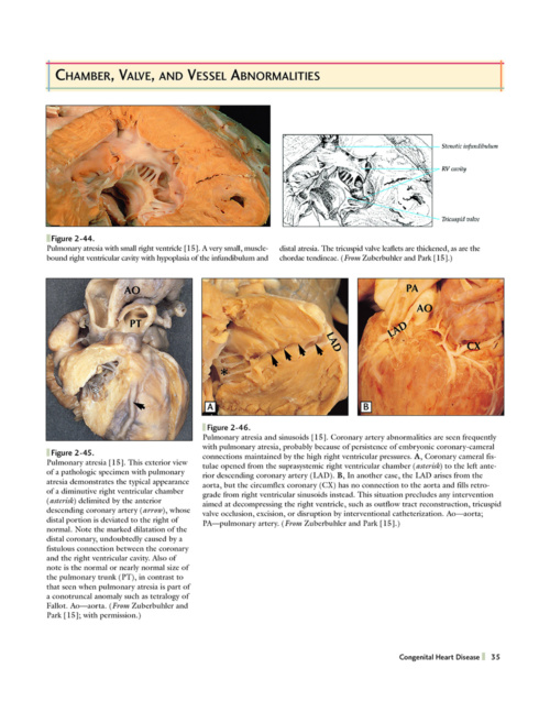 Atlas of Cardiovascular Pathology p35 1000x1294