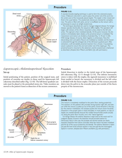 Atlas of Laparoscopic Laser Surgery p10 1000x1228