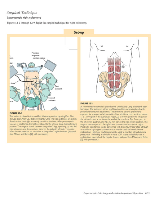 Atlas of Laparoscopic Laser Surgery p3 1000x1228