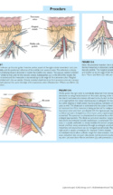 Atlas Of Laparoscopic Laser Surgery P5 1000X1228