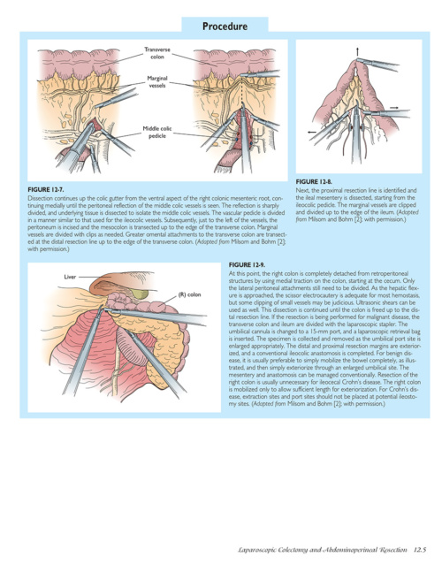 Atlas of Laparoscopic Laser Surgery p5 1000x1228