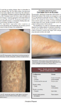 Current Practice Of Medicine Dermatology P11 1000X1293