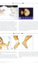 Atlas Of Pediatrics Page 3